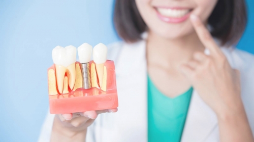 Вернуть белоснежную улыбку перед юбилеем поможет имплантация зубов